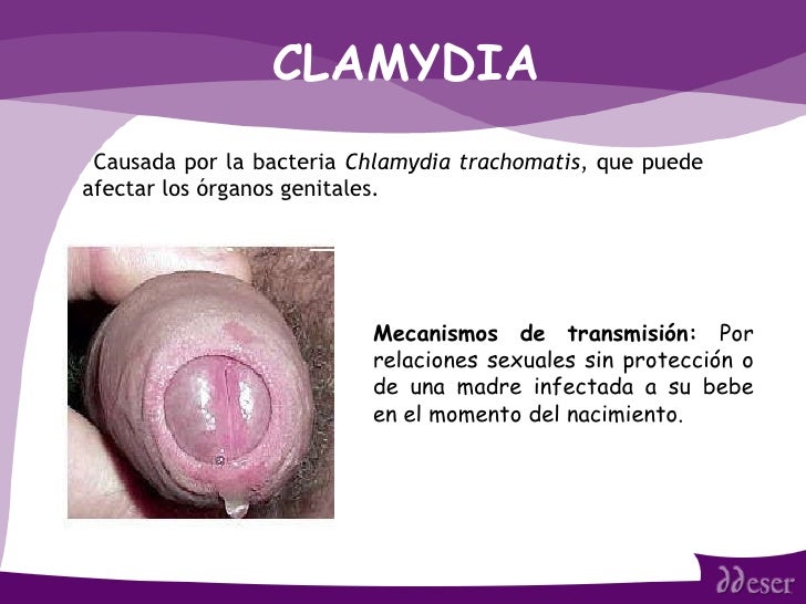 sexo anal sin proteccion